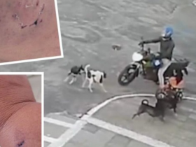 Agente Comunitária de saúde é atacada por cães na Bahia 27 1 51