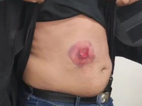 Policial Civil é Baleado Durante Operação ‘Pacificar’ no Prado, Mas é Salvo por Colete à Prova de Balas 15 1 56