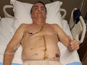 Pressão elevada e novos exames: entenda a 'piora clínica' de Bolsonaro, intimado na UTI de hospital 9 01 1