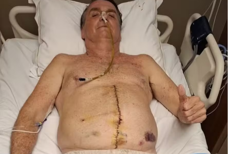 Pressão elevada e novos exames: entenda a 'piora clínica' de Bolsonaro, intimado na UTI de hospital 14 01 1