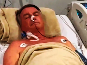 Cirurgia de Bolsonaro por obstrução intestinal apresenta riscos significativos, apontam especialistas 15 1 29