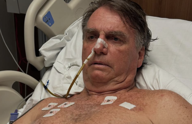 Bolsonaro ignora alerta sobre pressão alta e sofre piora clínica 26 1 50