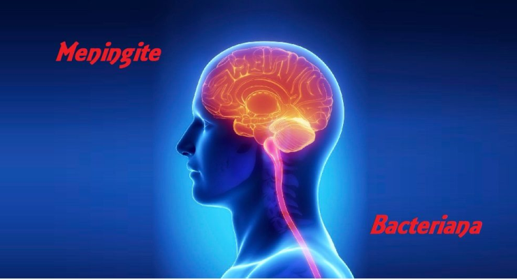 Meningite bacteriana: saiba o que fazer ao ter contato com a doença 30 2 9