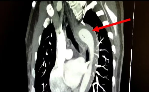 Mulher rompe aorta durante relação sexual e é levada às pressas para cirurgia 4 1 30