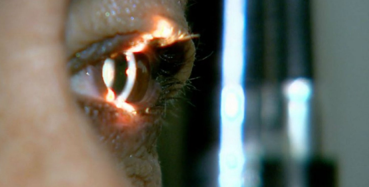 Editor do ItapebiAcontece faz cirurgia de olho na CDTO em Salvador pelo SUS e destaca Atendimento 21 5