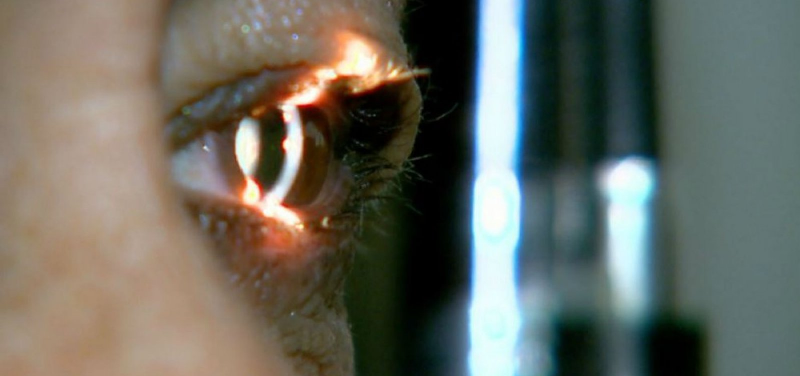 Editor do ItapebiAcontece faz cirurgia de olho na CDTO em Salvador pelo SUS e destaca Atendimento 1 5