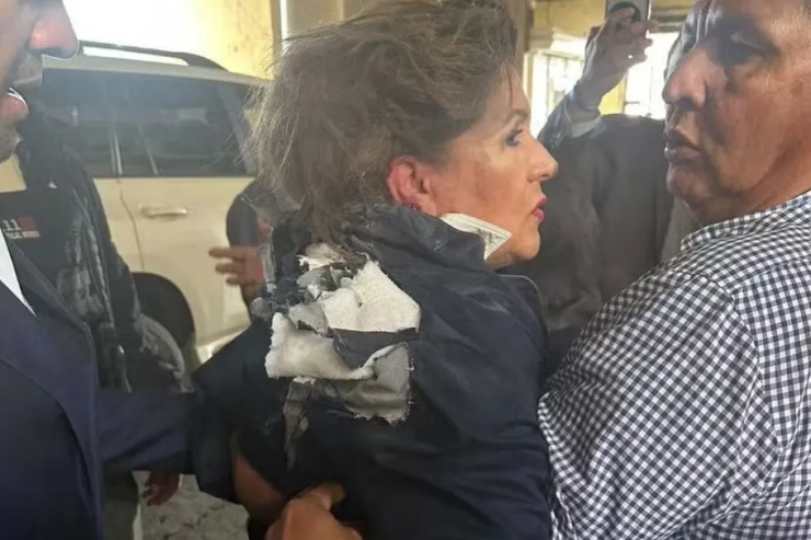 Cenas Fortes: Explosivo atinge cabeça de deputada em plena entrevista; veja o que se sabe 24 1 18