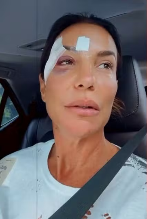 Ivete Sangalo recebe alta em Salvador e tranquiliza fãs após aparecer com olho roxo 1 3 10