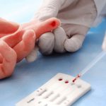 186194brasil vai na contramao do mundo e registra alta nos casos de hiv 3
