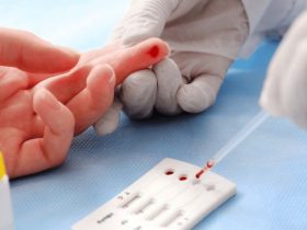 186194brasil vai na contramao do mundo e registra alta nos casos de hiv 3