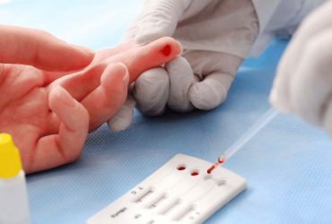 186194brasil vai na contramao do mundo e registra alta nos casos de hiv 3